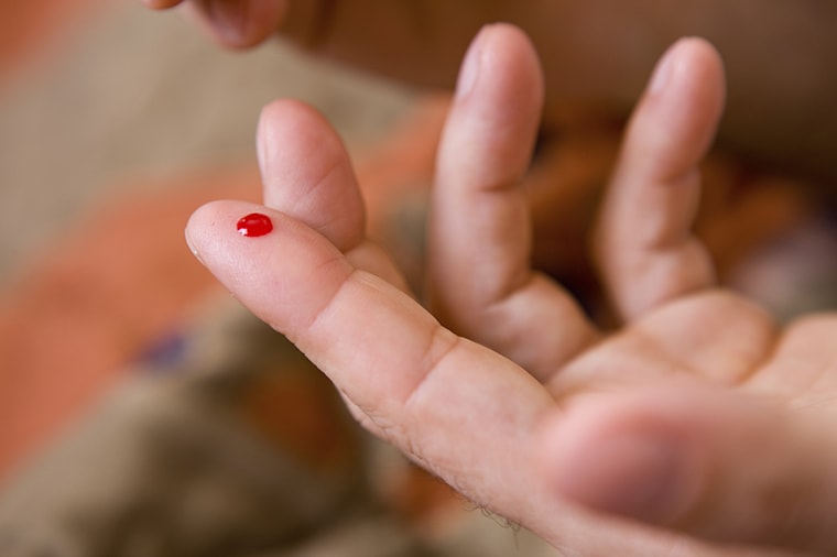 Гемофобия - как избавиться от страха крови?
