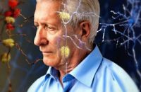 Иллюстрация / Десять изменений в образе жизни, которые защитят Вас от болезни Альцгеймера в старости