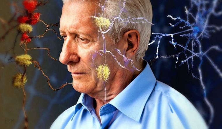 Десять изменений в образе жизни, которые защитят Вас от болезни Альцгеймера в старости